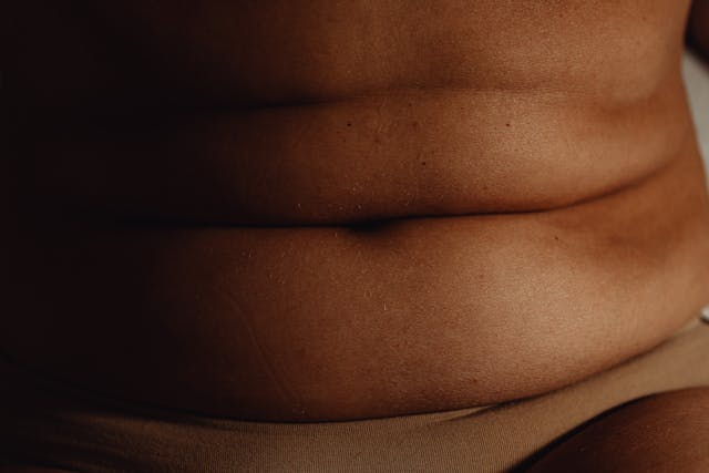 hypnosis the next natural treatment for ibs